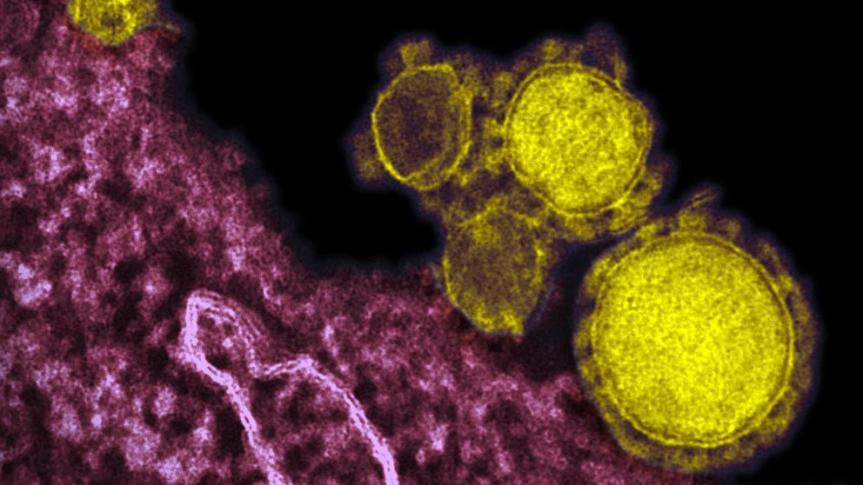Se registra primer caso de Coronavirus en&nbsp;EEUU