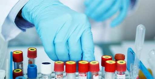 Jalisco suma 82 personas enfermas de COVID-19 y 4&nbsp;asintomáticas