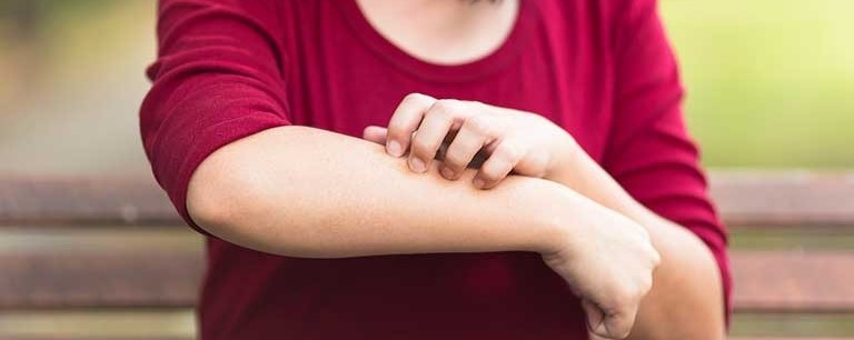 Los jóvenes que no dejan de rascarse y la dermatitis&nbsp;atópica