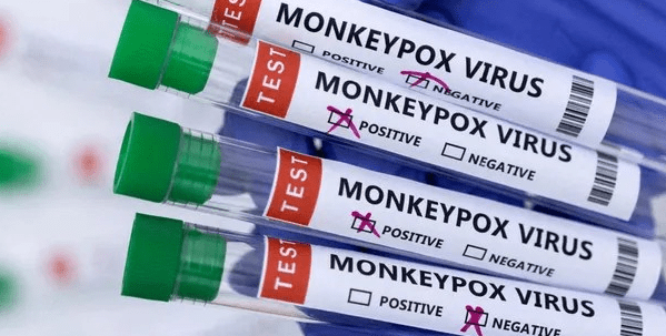 Detectan un primer caso Viruela Símica en Puerto&nbsp;Vallarta